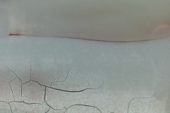 020525L1001580-631438